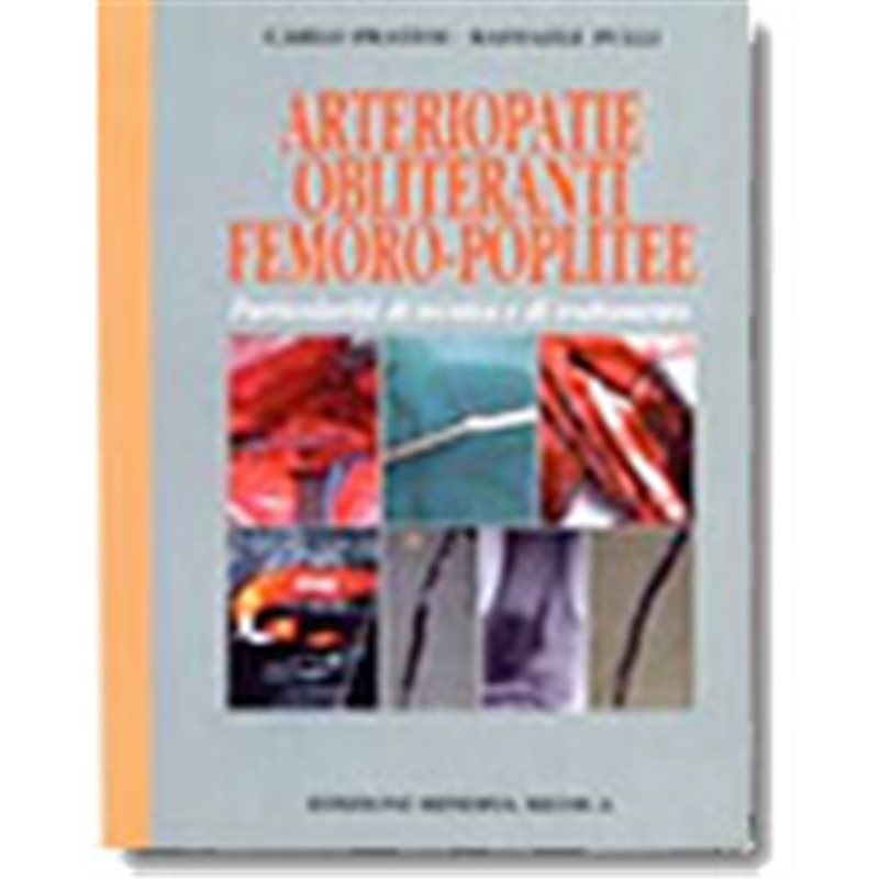 Arteriopatie Obliteranti Femoro-Poplitee -Particolarità di tecnica e di trattamento